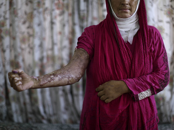 Ženy, ktoré nenávidia mužov!