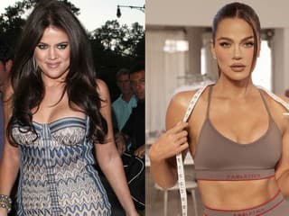 Tieto hollywoodske celebrity zmenili estetické úpravy na nepoznanie: Z koho je dnes úplne nový človek?