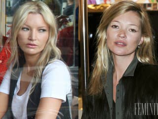 Dvojníčka Kate Moss, krásna Denise Ohnona to v živote nemala najľahšie: Hoci jej autonehoda zničila tvár, dnes ju práve tá živí