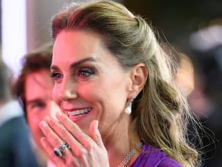 Ženy si dávajú pauzu od gélových nechtov: Táto manikúra vráti lesk bez jedinej vrstvy laku, miluje ju aj Kate Middleton!