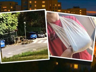 DESIVÝ ÚTOK na sídlisku: Muža napadla diviačica s 13 mladými! VIDEO Má potrhané väzy, mrazivé SVEDECTVO