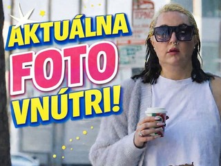 Herečka Amanda Bynes výrazne schudla, ale... Jej krása je aj tak dávno fuč!