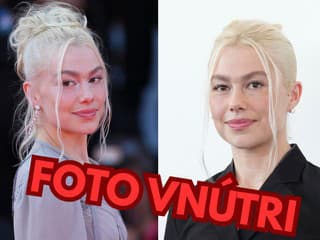 Americká kráska v Benátkach pobúrila: Pretŕčala chlpaté nohy aj prsia bez podprsenky!