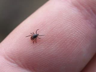 Zabudnite na aplikáciu oleja či mydla na kliešťa: Táto chyba zvyšuje riziko nákazy, čo radia odborníci?