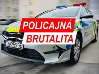 POLICAJNÁ BRUTALITA Mučili mladíka, ústa mu zalepili a fotili si to! Šokujúce ZISTENIA, čo všetko si vytrpel