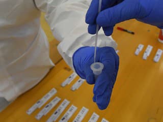 Novinka v Bratislave: Testovanie na HIV, syfilis a hepatitídu C bude dostupné aj v noci