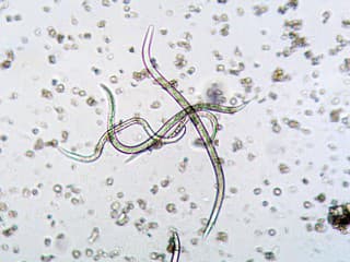 Parazity v nádrži Stará Myjava spôsobujú kožné vyrážky: Odborníci varujú pred kúpaním