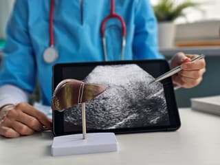 Alarmujúci nárast ochorení pečene na Slovensku: Ako včas ochrániť svoje zdravie?