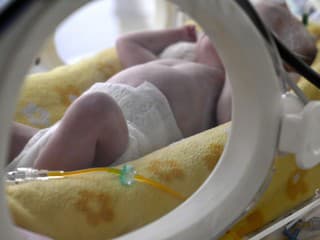 Vrodené srdcové chyby u detí: Diagnóza už pred narodením a boj o zdravie v nemocnici