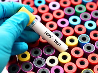 Košický kraj bojuje s nízkou prevenciou HPV: Účasť na očkovaní aj skríningu stále zaostáva
