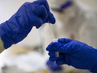 Pravidelné testovanie je dôležité pre prevenciu sexuálnych ochorení