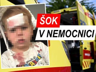 Chlapček mal ťažký úraz, rodičia bežali na urgent: Zažili ŠOK! Pre TOTO museli volať SANITKU do nemocnice