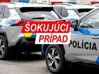 Šokujúci incident v škole: Žiak zapálil sprej, spolužiačke obhoreli vlasy