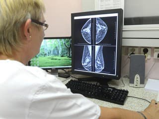 V Ružovom parku sa koná Deň pre zdravé prsia: Zúčastnia sa aj odborníci