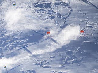 Správa, z ktorej doslova láme a trhá srdce: Nórsky lyžiar ochrnul po nehode na tréningu