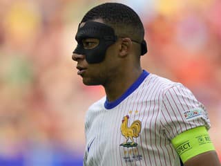 EURO 2024 Ako sledovať 3D: Deschamps opísal Mbappého masku, Francúzi čakajú na normálny gól