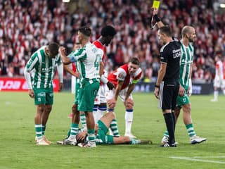 FOTO len pre silné povahy: Hráč Bohemians vyfasoval tvrdý kopanec rovno do hlavy