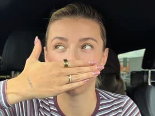 Laura Chrebetová sa nechala VYLEPŠIŤ: Na túto zmenu sa odhodlávala dlho!
