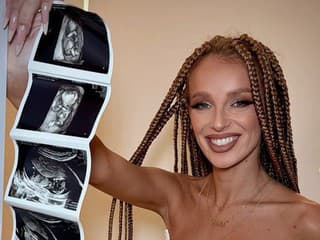 Speváčka Sima čaká bábätko: Zverejnila dojímavé video a fanúšikom prezradila detaily!