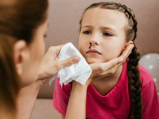 Lekárka varuje pred častou chybou: Toto pri krvácaní z nosa nikdy nerobte!