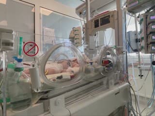 Šesťmesačnú dcérku mali udierať do tváre a hrudníka, krátko nato zomrela. Rodičia sa postavili pred súd