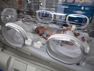 Žena náhle zomrela pri pôrode, no vďaka jej hrdinstvu sa podarilo zachrániť bábätko. Lekári hovoria o zázraku
