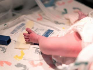 Niečo nevídané, rozplýva sa lekárka. Takýto pôrod sa stane len raz za 15 miliónov prípadov