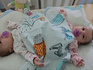 Lekári sú pripravení oddeliť slovenské siamské dvojčatá. Do cesty sa im však postavila vážna prekážka