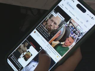 Údery do lícnych kostí či karfiolové ucho. Lekári varujú pred nebezpečnými trendmi mladých