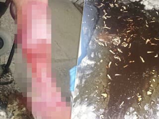 FOTO: Slovenský lekár riešil šokujúci prípad. Muž mal v nohe toľko živých červov, že sa nedali spočítať