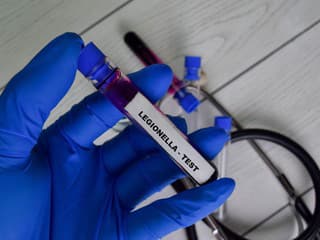 V Rakúsku sa šíri nebezpečné ochorenie. Zabilo už troch ľudí, nakazených pribúda