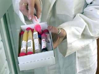 Pupočníková krv zo Slovenska končila pri experimentálnych terapiách. Holandská inšpekcia potrestala lekára