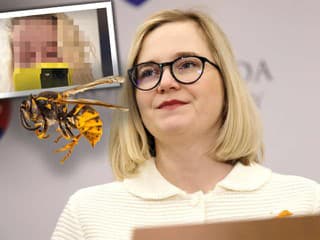 Bodnutie OSOU a náhly strach o život! Poslankyňa SaS skončila s vážne opuchnutou tvárou na URGENTE