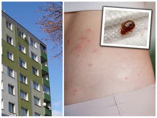 Ľudia v Bratislave si počítajú štípance: Sídliskom sa šíri nebezpečný PARAZIT, môže dôjsť k zamoreniu