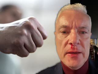 Dobitý Ferenčák na ulici: Prvýkrát prehovoril ÚTOČNÍK Stano, politik mal pred útokom napomenúť hlučnú partiu!
