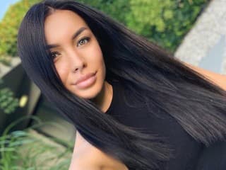 Známa markizáčka má nové prsia: FOTO Ukázala výsledok po plastike... Toto ju stálo 5000 eur!