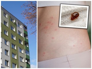 Ľudia v Bratislave si počítajú štípance: Sídliskom sa šíri nebezpečný PARAZIT, môže dôjsť k zamoreniu