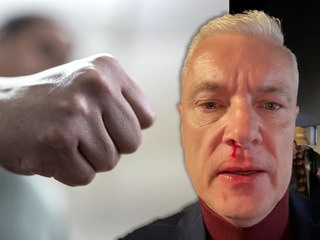Dobitý Ferenčák na ulici: Prvýkrát prehovoril ÚTOČNÍK Stano, politik mal pred útokom napomenúť hlučnú partiu!
