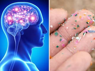 Alarmujúce výsledky štúdie: Mikroplasty prenikajú do mozgu! Neochráni vás ani tento spôsob stravovania