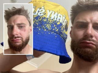 BRUTÁLNY útok krajanov v Česku: Poliaci ZMLÁTILI Poliaka! Farby na jeho klobúku si pomýlili s ukrajinskými