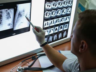 Jedna z najnebezpečnejších druhov rakoviny: Tieto príznaky často prehliadame