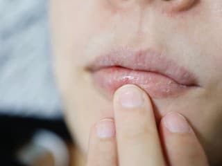 Popraskané pery a suché ruky zo zimy? Rýchlu pomoc prekvapivo nájdete v kuchyni