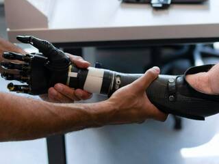 Môže človeku raz dorásť ruka či noha? Nová štúdia ukazuje genetickú cestu, ktorá by to mohla umožniť