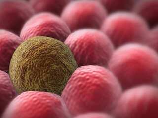 Rakovina si pri raste ničí vlastnú DNA. Vedci ukázali, ako tým vzniká priestor pre ďalšie mutácie