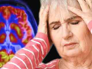 Alzheimerova choroba sa u niektorých ľudí nikdy neprejaví stratou pamäti. Vedci odhalili kľúčový rozdiel v ich mozgoch