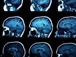 AI od Mety sa priblížila k čítaniu myšlienok. Dokáže to bez implantátu aj bez operácie mozgu