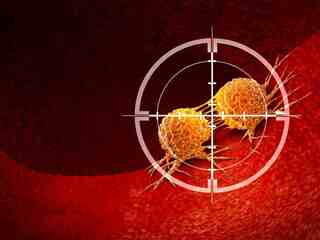 Nové experimentálne látky dokázali zlikvidovať „zombie bunky“ v nádoroch. Vedci im vypli ochranný štít, ktorý ich držal pri živote