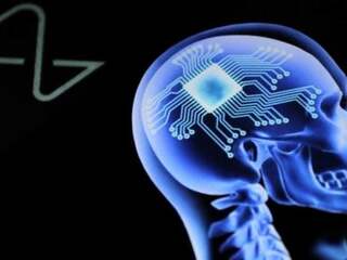 Ochrnutý pacient s čipom Neuralink sa naučil hrať World of Warcraft len mysľou. Toto dokáže po 100 dňoch