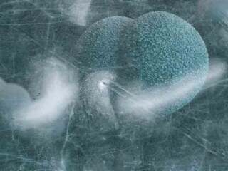 Vedci prebudili baktériu z ľadu starého 13-tisíc rokov. Odolala viacerým moderným antibiotikám