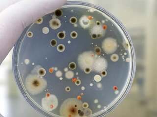 Prelom vo vede! Výskumníci predstavili antibiotikum, proti ktorému baktérie nemôžu získať odolnosť